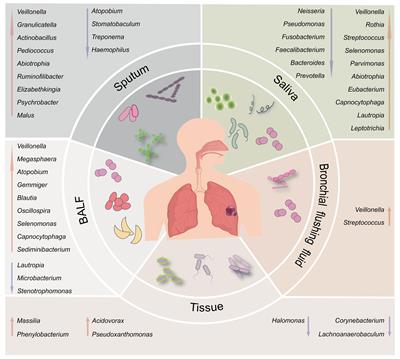 Symbiotic microbial communities in various locations of the lung cancer respiratory tract along with potential host immunological processes affected